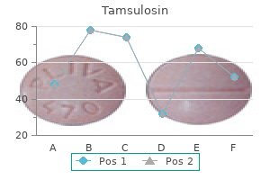 0.2 mg tamsulosin discount otc